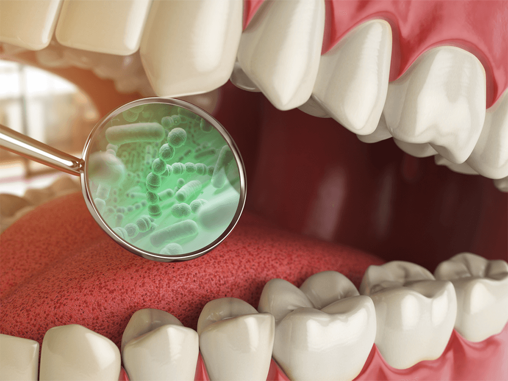 3D mockup showing odor causing bacteria in mouth