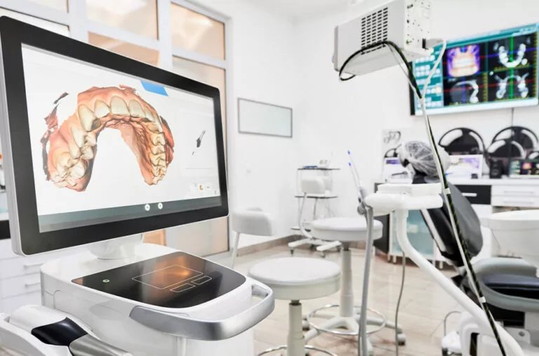 Screen showing 3D scan of upper arch of teeth